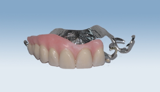 a vitallium 5