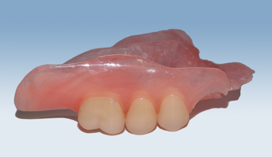 valplast 2