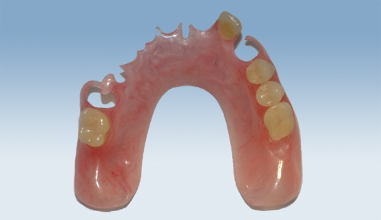 valplast 3